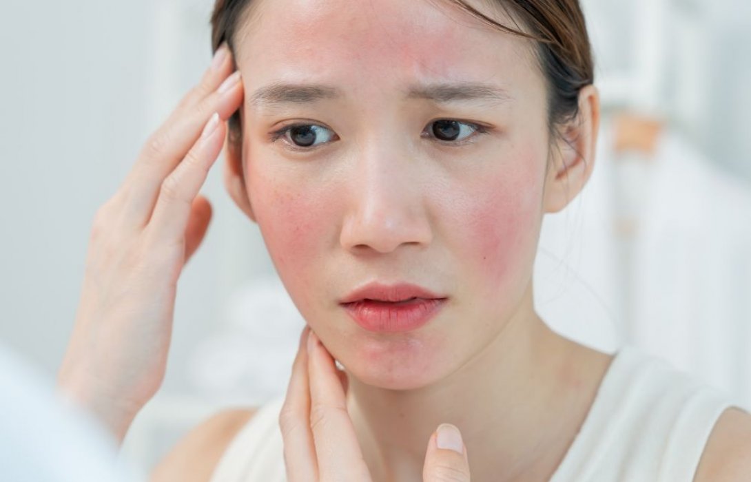 รักษาผิวกับคลินิกผิวหนัง ช่วยลดความเสี่ยงอะไรได้บ้าง