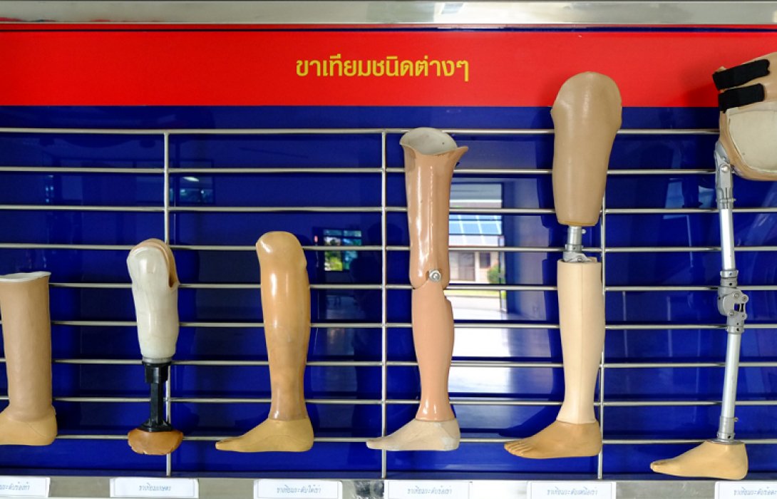 กาวของฉัน.. สานฝันขาของเธอ