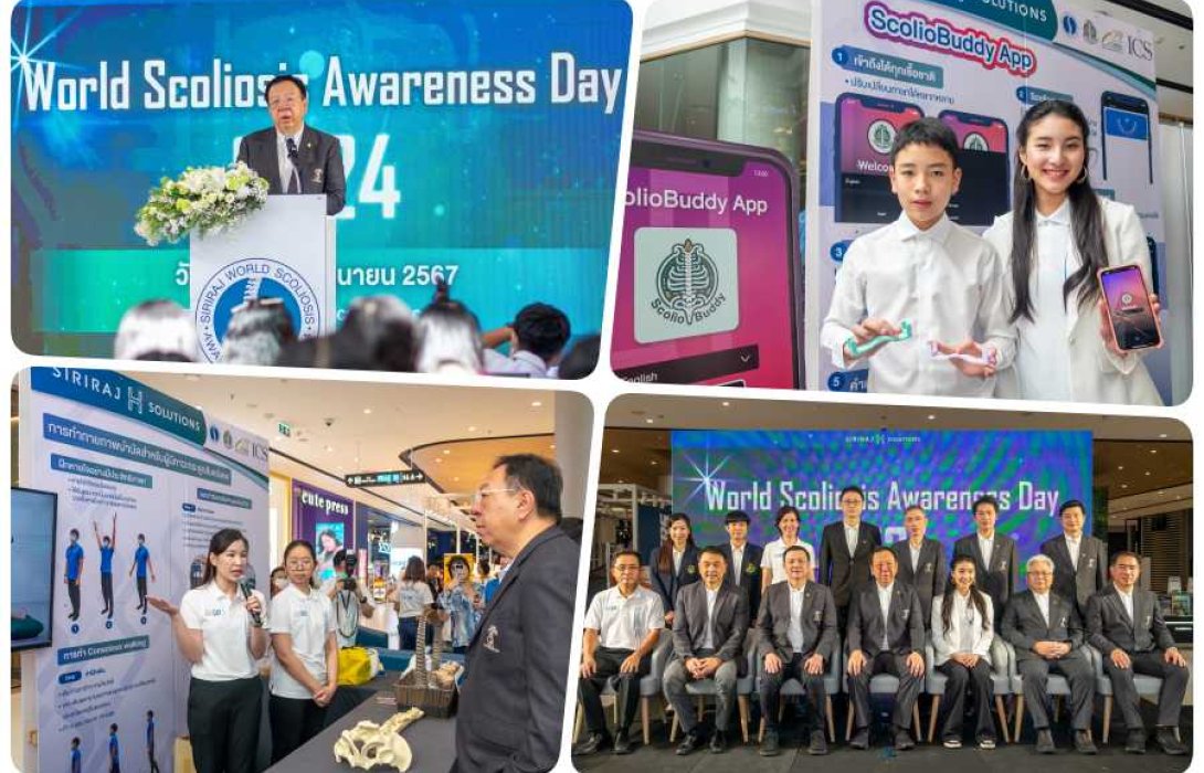 ICS ร่วมกับ SIRIRAJ H SOLUTIONS จัดงาน “WORLD SCOLIOSIS AWARENESS DAY 2024” สร้างความตระหนักรู้โรคกระดูกสันหลังคด พร้อมเปิดตัว ScolioBuddy Application 