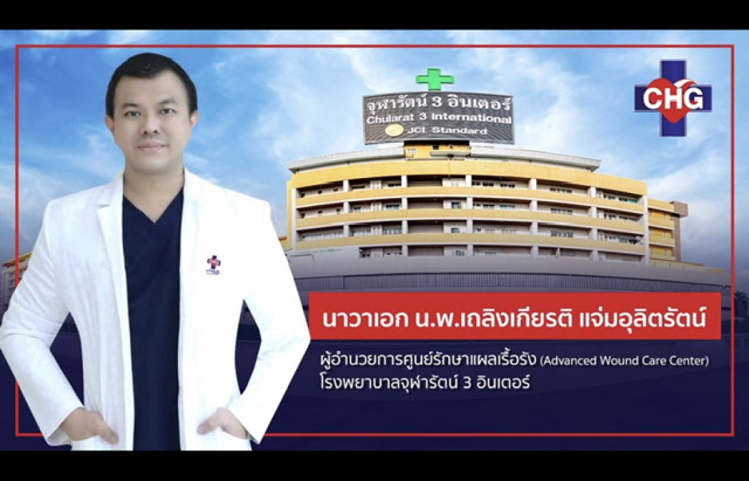 ศูนย์รักษาแผลเรื้อรัง CHG เพื่อการรักษาอย่างตรงจุด ลดการสูญเสียอวัยวะของผู้ป่วยเบาหวาน